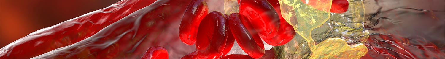 Cardiovascular Atherosclerosis 2026: Prediction, Prevention and Management Banner